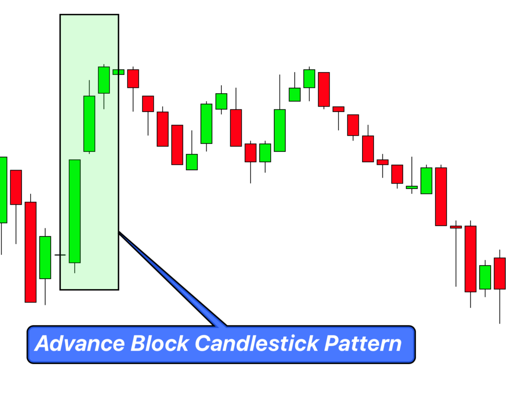 advance block example